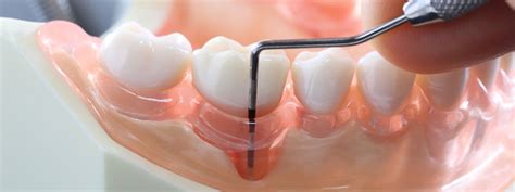 Periodontology .